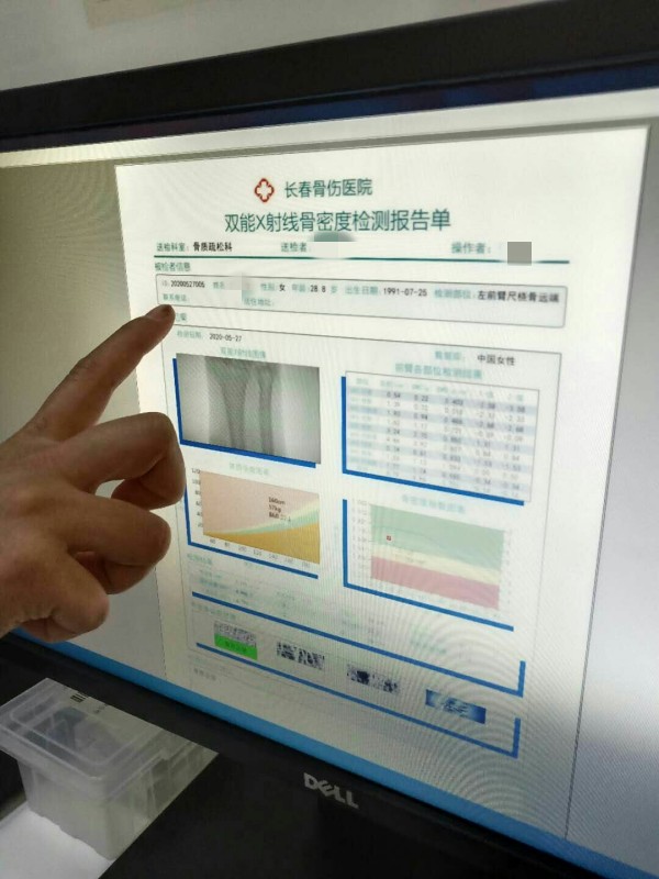 品源雙能X射線骨密度儀落戶吉林省長春骨傷醫(yī)院，助力骨松診療