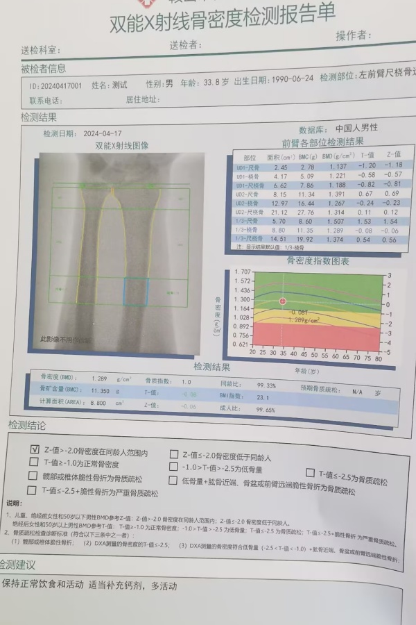雙能X射線骨密度儀：準(zhǔn)確測(cè)量骨密度，助力骨質(zhì)疏松防治，守護(hù)骨骼健康